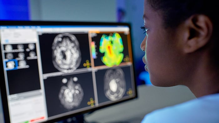 Philips Healthcare smart, connected radiology solutions