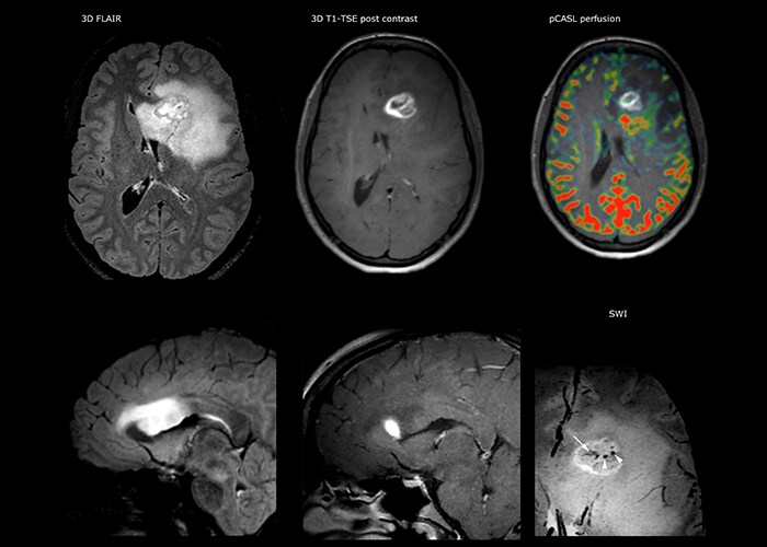 Morphologic imaging and perfusion