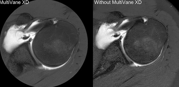 mri multivane comparison 1