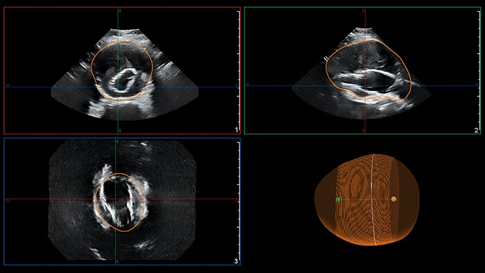 Ultrasound image