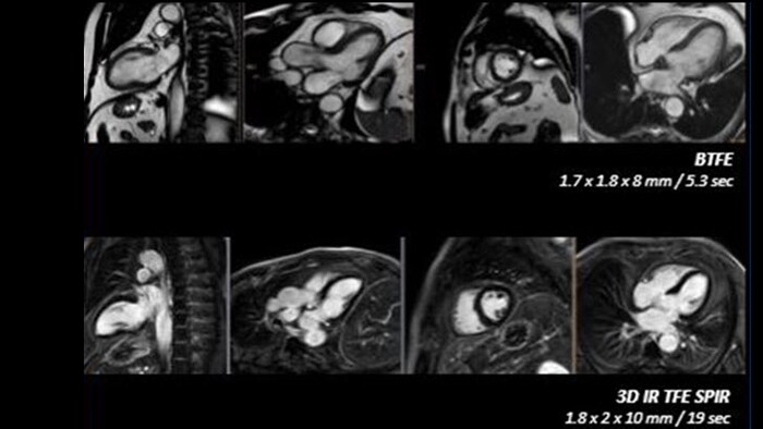 High quality diagnostic imaging