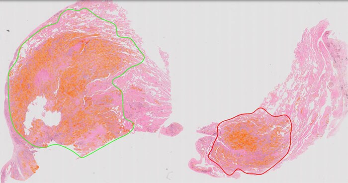Download image (.jpg) Philips IntelliSite Pathology Solution for clinical use